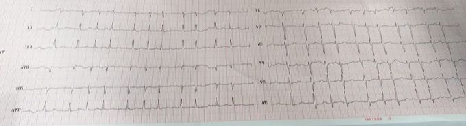 What's your diagnosis? What do you suggest for management?