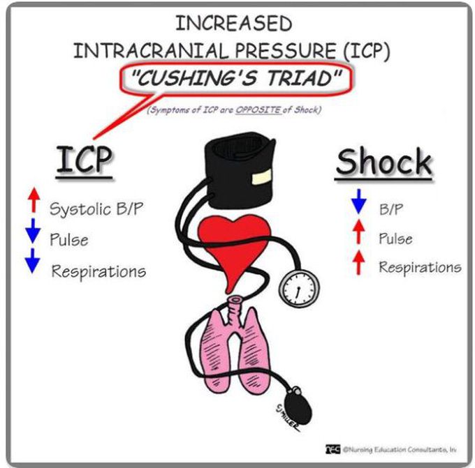 Cushing triad