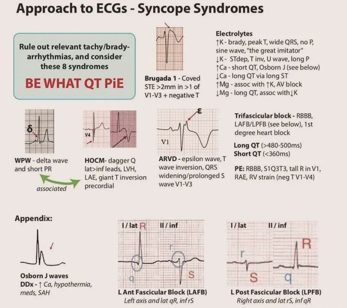 Approach to ECG