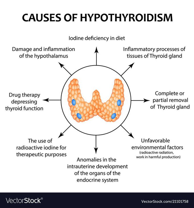 Causes of Hypothyroidism