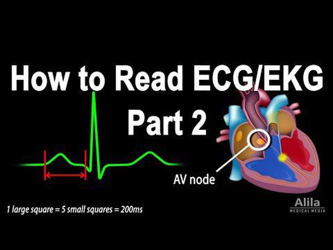 Reading an ECG Part II