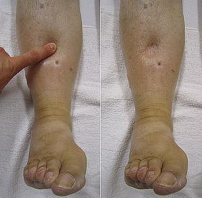 Put the name of this condition...?
