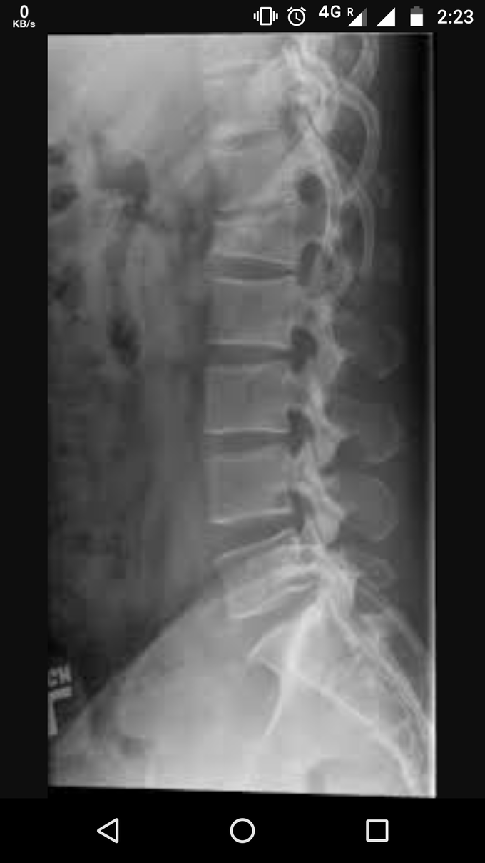 Diagnosis???