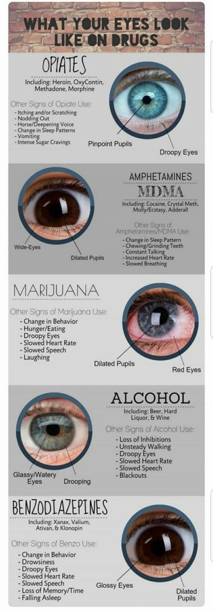 Physical Changes In The Eyes Of Drug Addicts