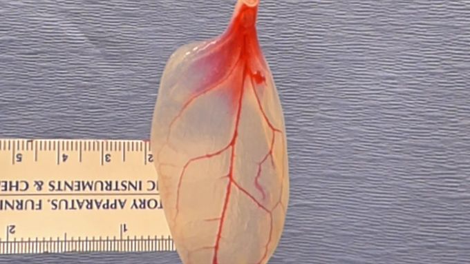 Spinach leaves can carry blood to grow human tissues