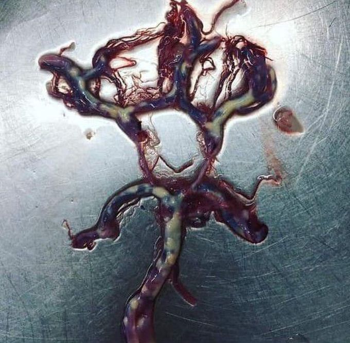 CIRCLE OF WILLIS