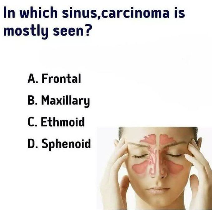 Sinus Carcinoma