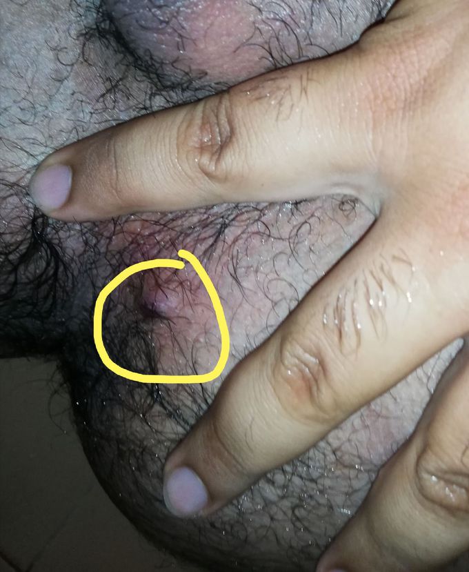 What is the diagnosis? 