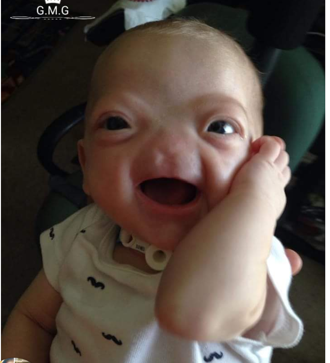 What genetic disease is it ?