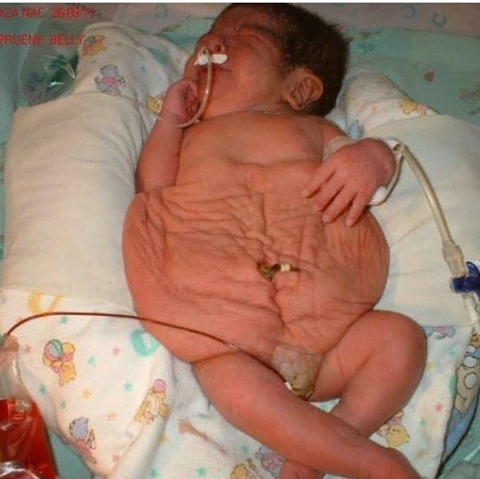 Diagnose it???