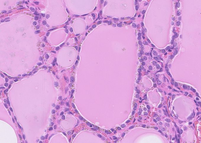 Epithelium of spinal cord - MEDizzy