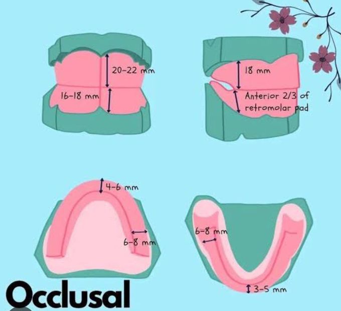 Occlusal Rim Dimensions