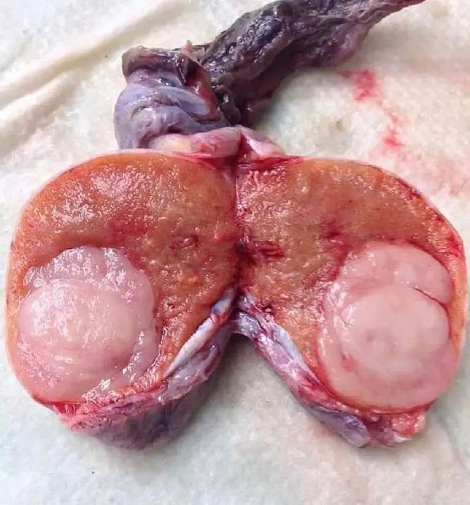 Whats your diagnosis?