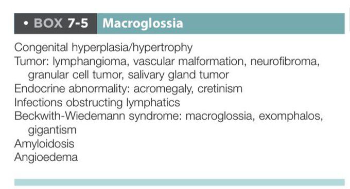 Macroglossia