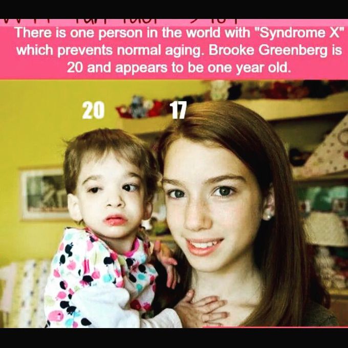 Syndrome