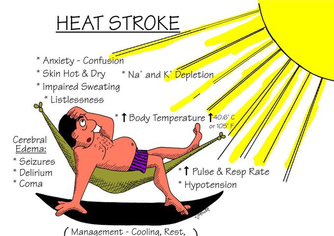 Cause of Heat stroke