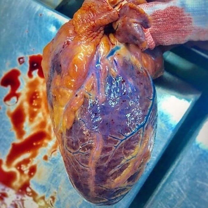 Heart