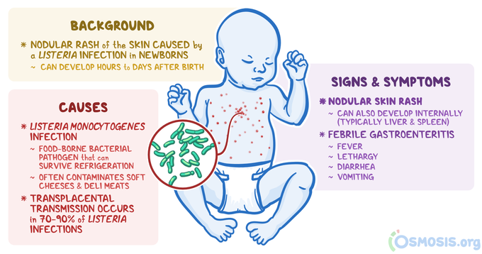 Granulomatosis infantiseptica