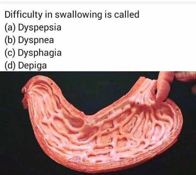 Difficulty in Swallowing
