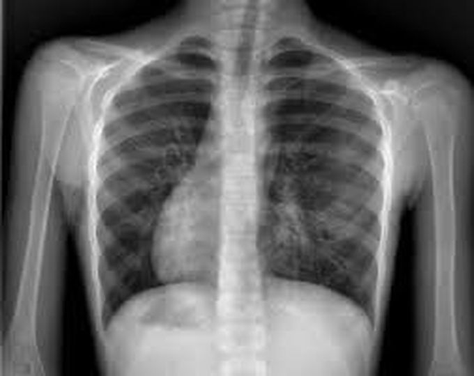 Question of the day - Pulmonology