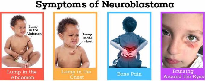 Symptoms of neuroblastoma