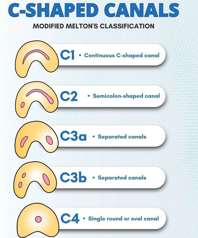 Modified Melton's Classification