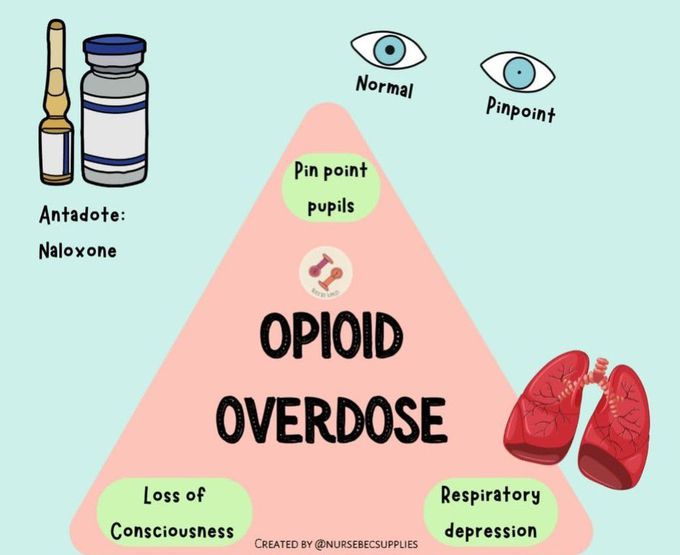 Opioid Overdose Triad