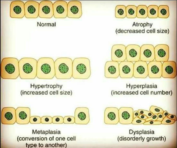 Cells' pathology 🌟⏫