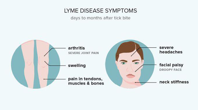 These are the symptoms of Lyme syndrome