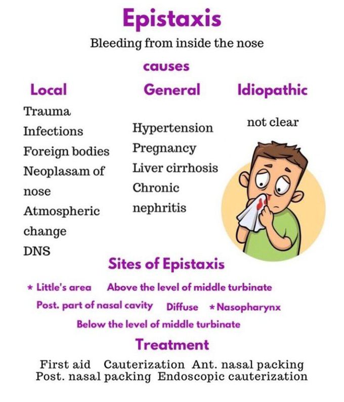 Epistaxis