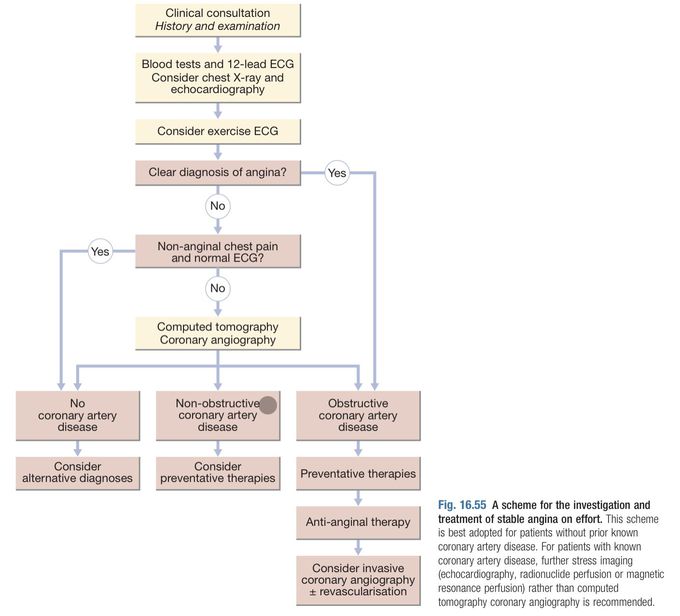 Algorithm for Investigation and Management of Stable Angina