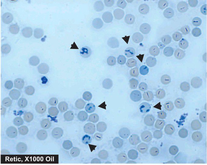 Reticulocytes