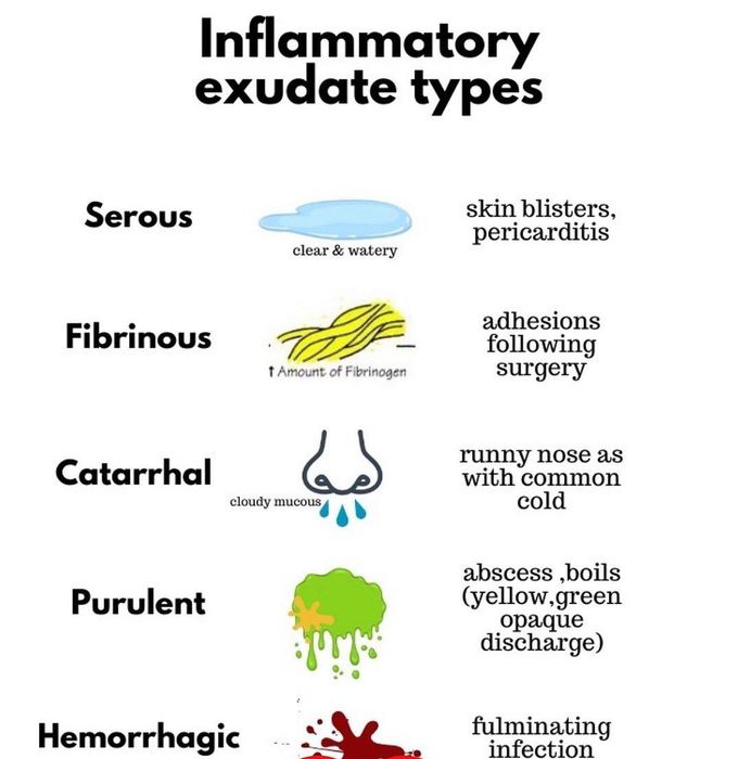 Inflammatory Exudate Types - MEDizzy