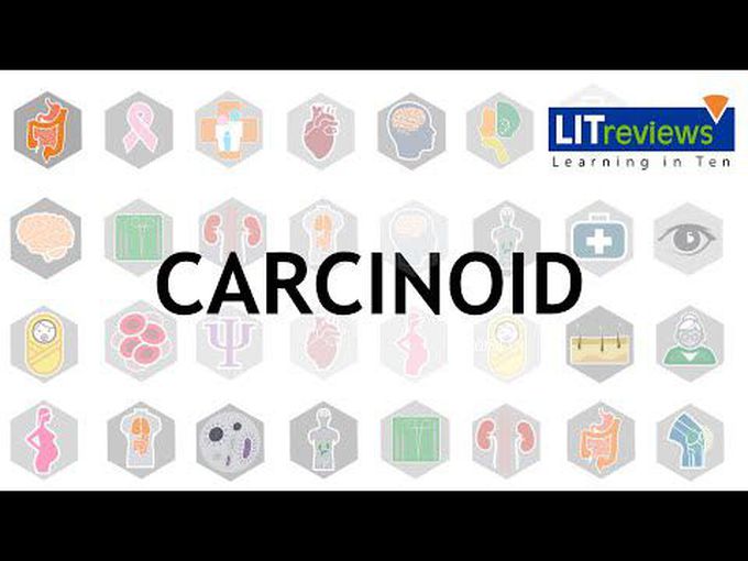 Carcinoid Tumor: Overview