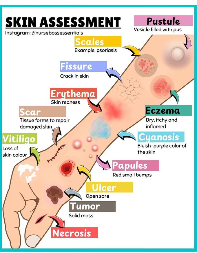 Skin Assessment