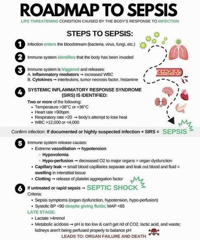 Sepsis Roadmap