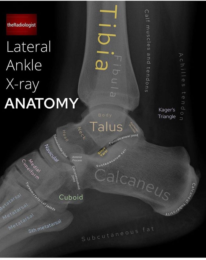 Lateral Ankle X-ray Anatomy