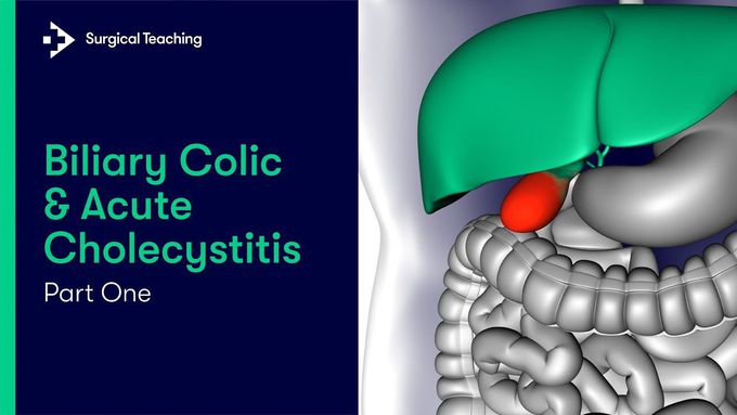 Biliary Colic & Acute Cholecystitis Part 1