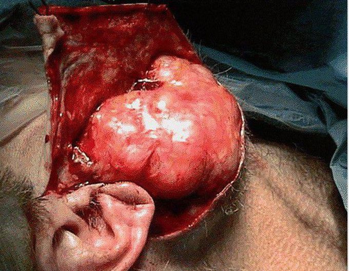 general surgery