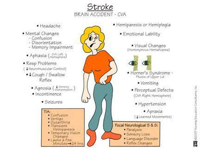 Stroke