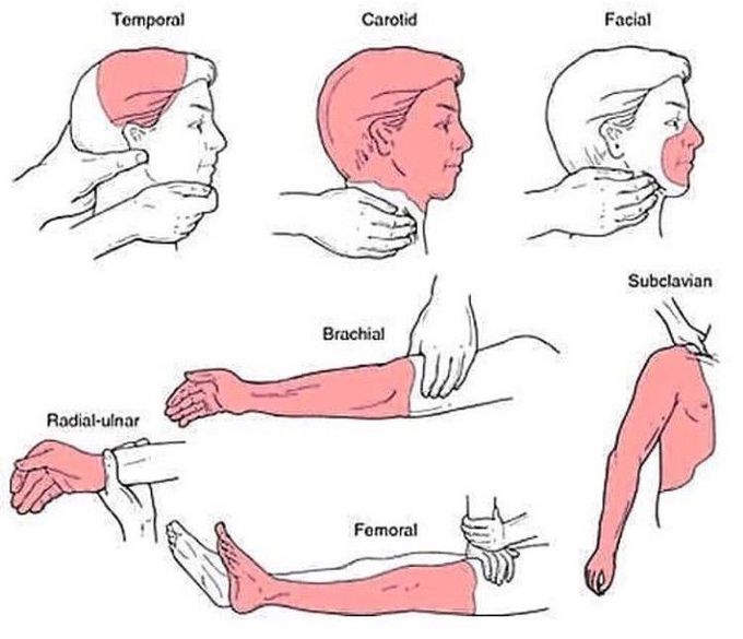 Stopping Excessive Bleeding