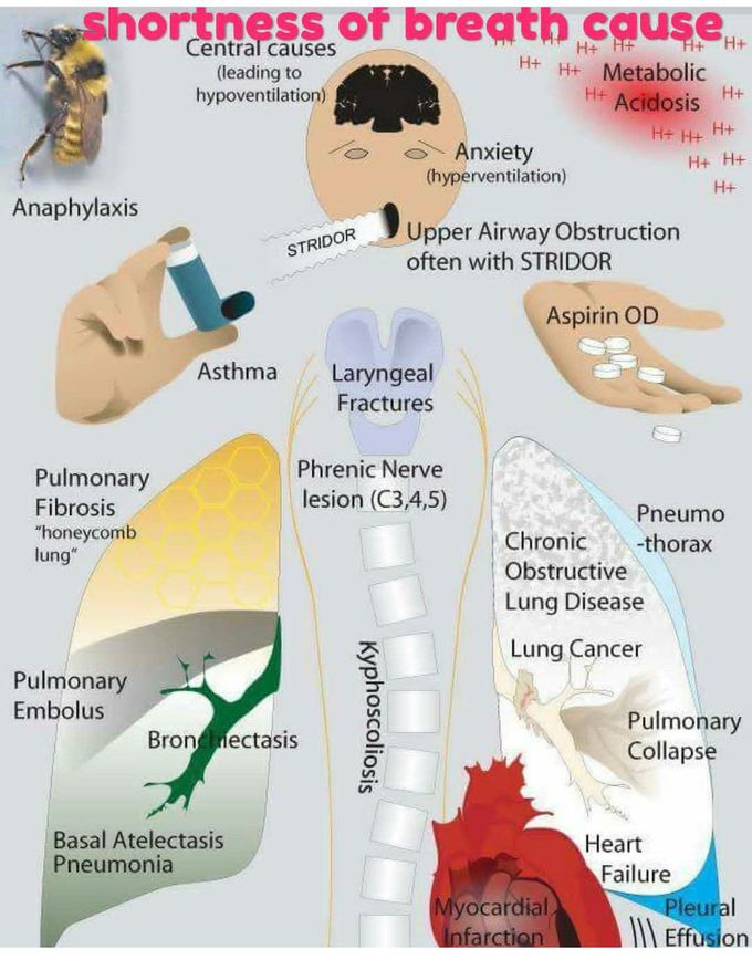 Causes of shortness of breath - MEDizzy