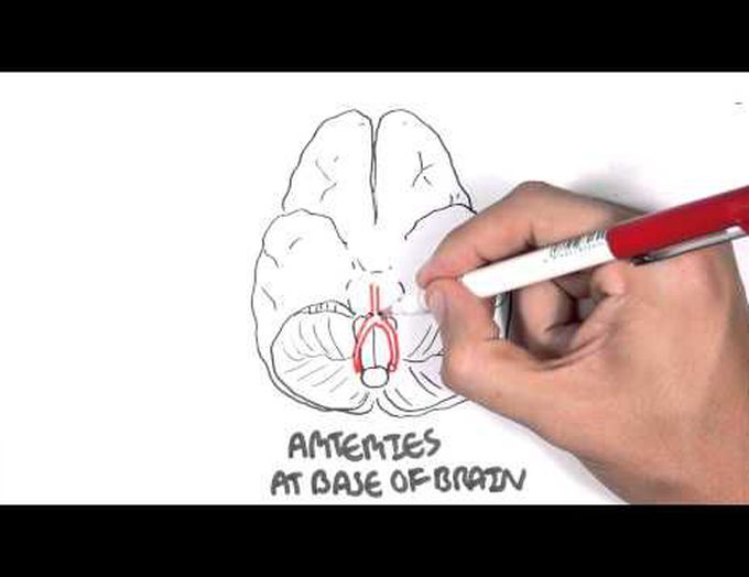 Anatomy of the Circle of Willis