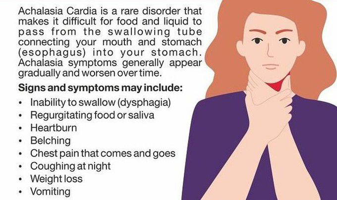 Symptoms of Achalasia