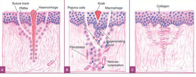 Primary union of skin wounds