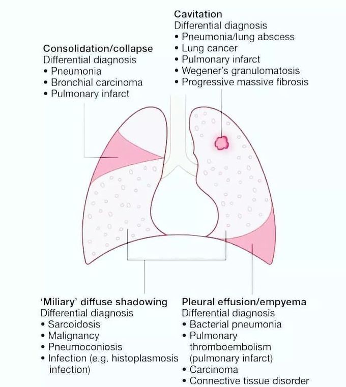 Different lung pathologies