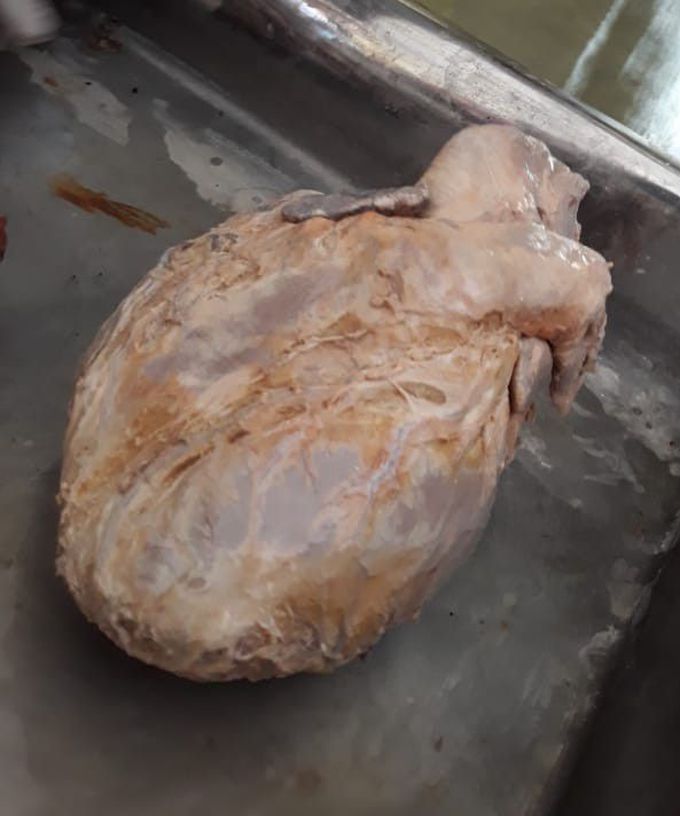 Human heart