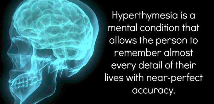 Hyperthymesia.......Who want this condition?