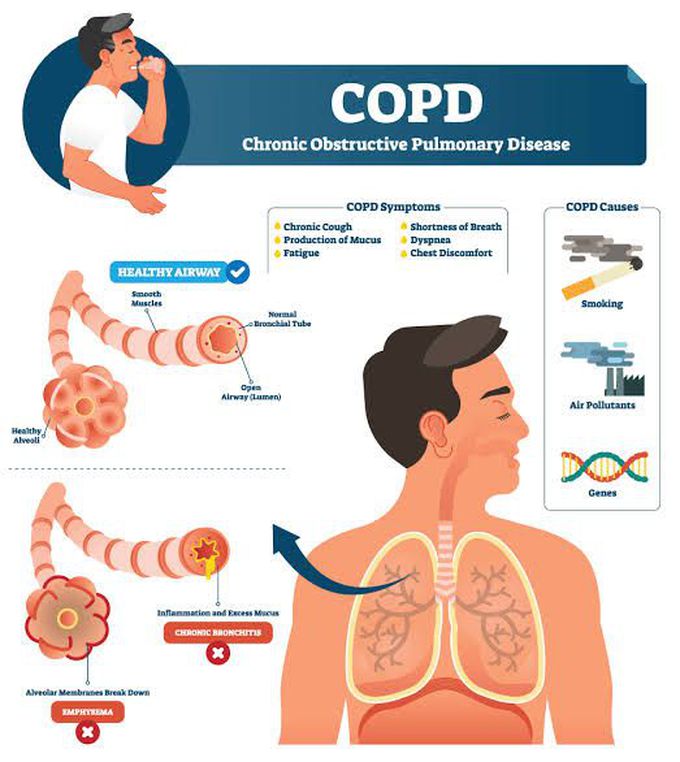 Symptoms of copd