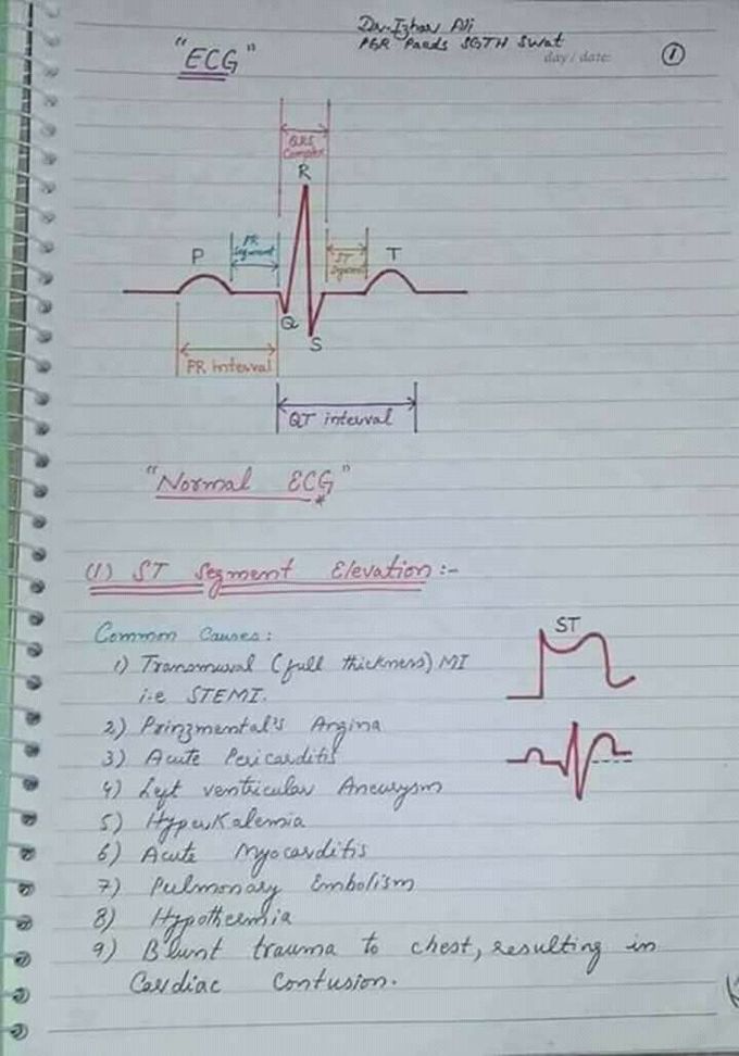 ECG